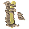 Ankle Impingement Problems