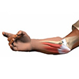 Ankle Syndesmosis Injuries