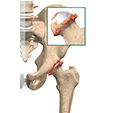 Ankle Syndesmosis Injuries