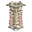 Peroneal Tendon Subluxation