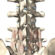 Artificial Joint Ankle