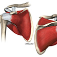 Ankle Impingement Problems