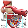 Peroneal Tendon Problems