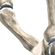 Peroneal Tendon Problems