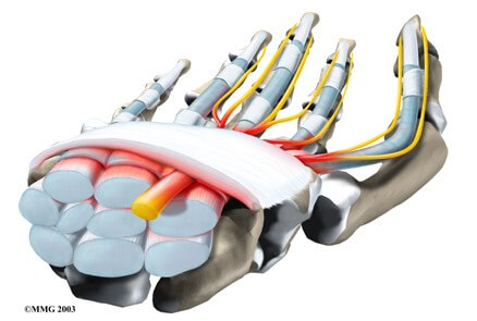 Carpal Tunnel Syndrome	