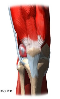 Iliotibial Band Syndrome	