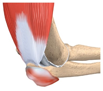 Olecranon Bursitis	