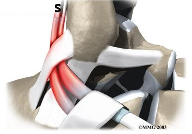 Peroneal Tendon Problems	