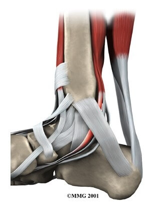 Posterior Tibial Tendon Problems	