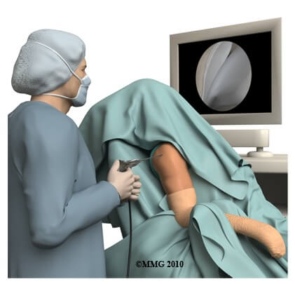 Shoulder Arthroscopy	