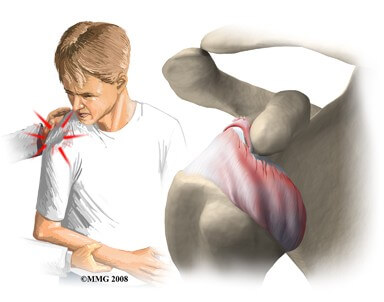 Shoulder Dislocations	