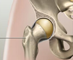 normal hip joint
